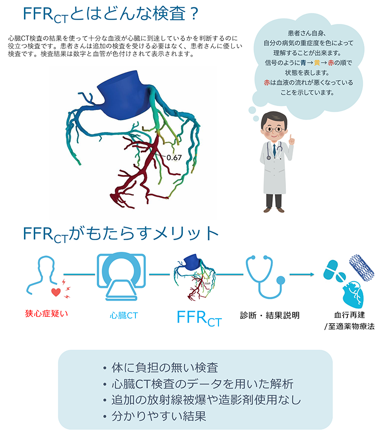 労作性狭心症・無症候性心筋虚血に対するFFRct検査について