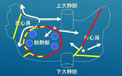 迷路のような伝導路を、高周波を用いた機器等にて遮断する