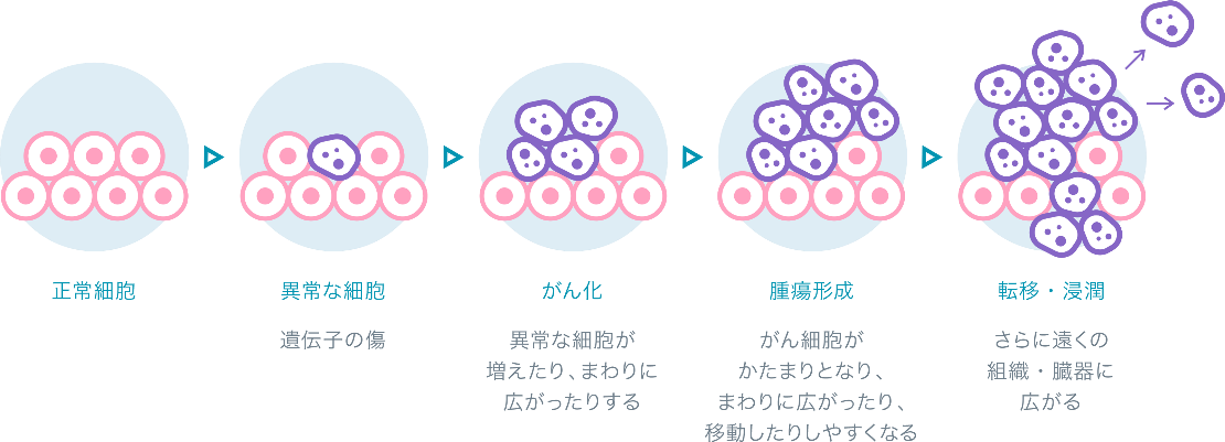 がんゲノム外来について