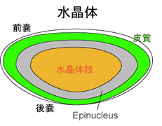 白内障