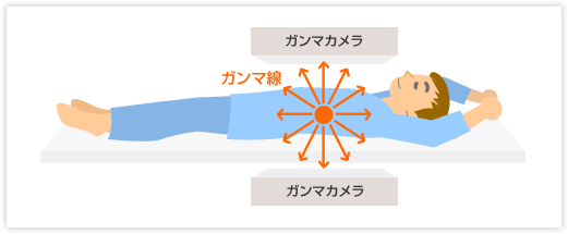アイソトープ検査の模式図