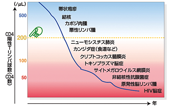 AIDSとは