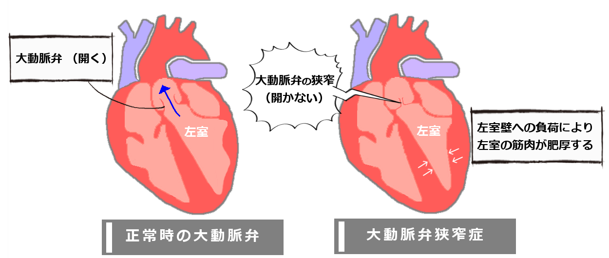 病気の説明